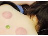 【PCやスマホによる眼精疲労・頭痛など】お身体の鍼灸　80分 ￥10800→8800