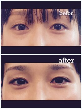 ブルーシエル(BLEU CIEL)/目元フルコース