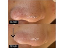 オリーゴ アイラッシュ(origo.eyelash_A/N)