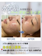 ノット(knote)/衝撃ビフォアフ3