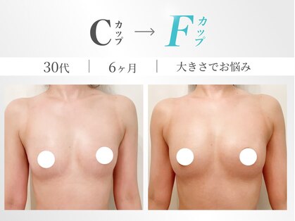 ベルビューティー(belle beauty)の写真