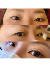 シャンティ(Shanti)/パリジェンヌとドライヘッドスパ