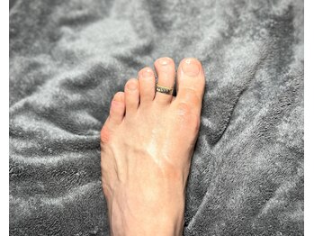 ナディオ 新宿(NADIO)/見落としがちな指毛の処理