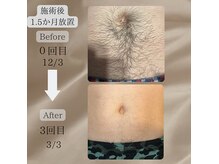 ネイチャー(Nature)の雰囲気（特許取得のイオン導入で脱毛しながら美肌に♪　【メンズ脱毛】）