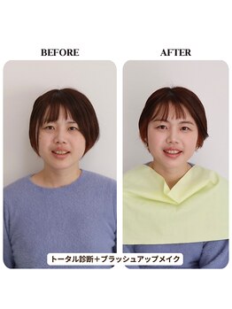 シュアリー(Surely)/トータルコースお客様