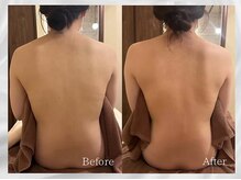 ベレガ 大阪本店(BELEGA)/◆ボディ施術ビフォーアフター◆