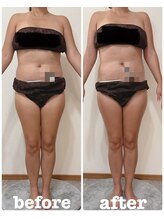 レヌール(LENULE)/リンパマッサージ