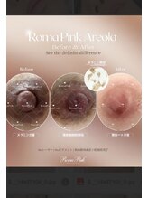 ツボミ(tubomi)/ローマピンク｜バストトップ…１