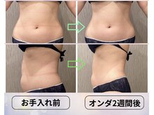 アランチャンティック(AlamCantik)