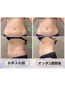 ボディラインを整えたい