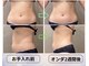 アランチャンティック(AlamCantik)の写真/【結果重視痩身◎】韓国式エステマシン”オンダマイクロリフト”で憧れの美ボディラインに♪[痩身]