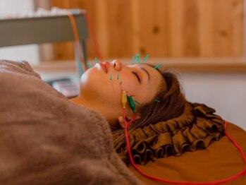 黒田鍼灸治療院の写真/美容鍼+微弱電流でより引き締めリフトアップ+こだわりの手技で血流やリンパの滞りを整えます!小顔&美肌へ◎