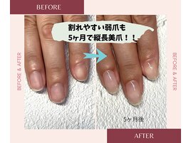 割れやすい弱爪も劇的変化