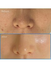 レティティア(Laetitia)/リピート率99％セラピール