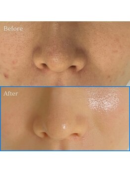 レティティア(Laetitia)/リピート率99%セラピール