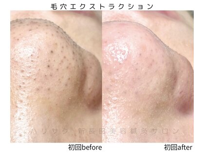 ハリサクの写真