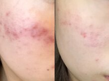 チャロアイト 可部店(Charoite)/お悩みの方に！