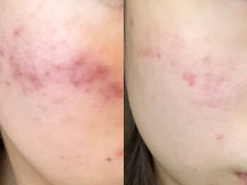 チャロアイト 可部店(Charoite)/お悩みの方に！