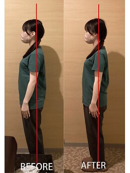 つばさ整体院 経堂駅前店/お客様ビフォーアフター