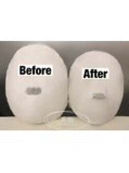 美極 銀座店/銀座/小顔コルギ/小顔矯正