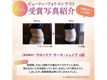 ビューティーサロン アンジュエール/一箇所集中ダイエット♪