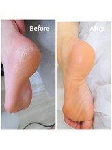 リゼラアンドコー 表参道店/