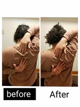 アース エンジェル整体院/ビフォアフ　肩甲骨はがし