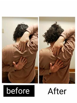 アース エンジェル整体院/ビフォアフ 肩甲骨はがし