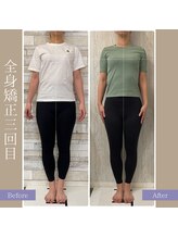 キアラ(chiara)/全身矯正3回目(正面)