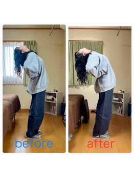 花巻ひふみ整骨院/骨盤が原因の腰痛改善(女性)