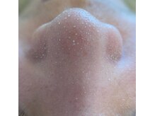 マヴィ(Mavie)/韓国式３D毛穴洗浄