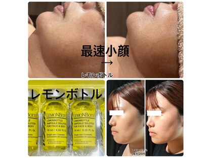ビオトナス(Facial Esthe)の写真
