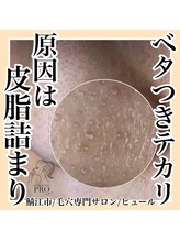 ピュール 鯖江店(PUR)/毛穴サロン/毛穴ケア/毛穴洗浄