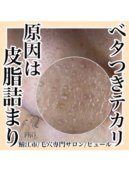 ピュール 鯖江店(PUR)/毛穴サロン/毛穴ケア/毛穴洗浄