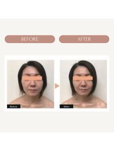 シャンタイン(SANTAI)/エラスチンフェイシャル