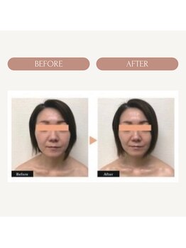 シャンタイン(SANTAI)/エラスチンフェイシャル