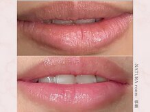 ナチュラルーム 那覇(NATURA room)/ローマピンク/リップ施術