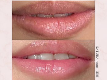 ナチュラルーム 那覇(NATURA room)/ローマピンク/リップ施術