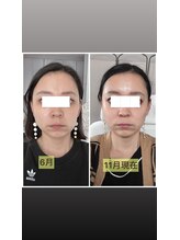 リリースパ 辻堂店(Lily spa)/顔が一回り小さくなる！！