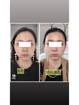 リリースパ 辻堂店(Lily spa)/顔が一回り小さくなる！！