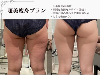 ラブミー 渋谷本店(LoveMe)/骨盤/下半身痩せ/痩身/あしやせ