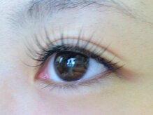 レミッカ チャナッカ(Remikka Chanakka)/ぱっちりコース