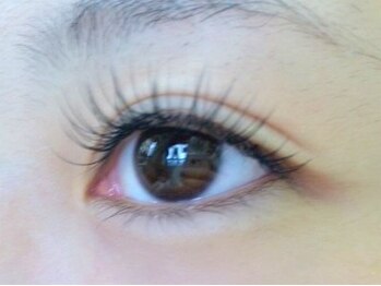 レミッカ チャナッカ(Remikka Chanakka)/ぱっちりコース