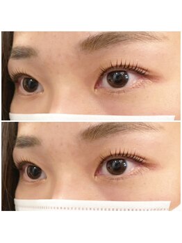 グリッターネイル(GLITTER NAILS)/セラムラッシュリフト