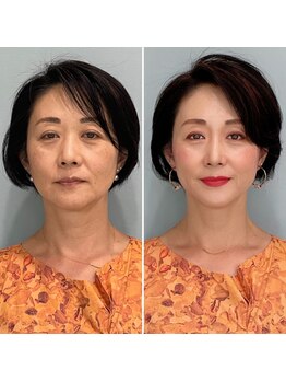 エイジレスビューティーアカデミー(Ageless Beauty Academy)/韓国オルチャンメイクレッスン