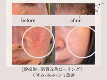 シェリーボーテ(Shelly beaute)の雰囲気（［肌質改善］自分ケアでは物足りない方本格エイジングケアサロン）