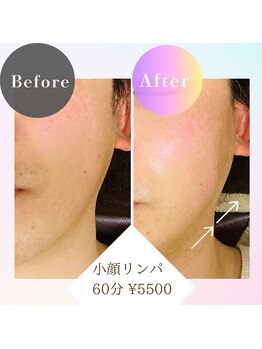 リアン(Lien)/小顔リンパ