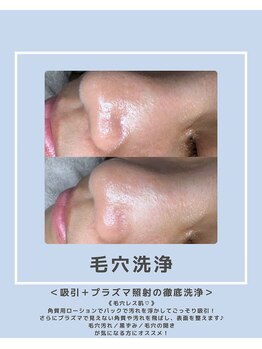 ソワナ(soina)/【神楽坂駅/フェイシャル/毛穴】