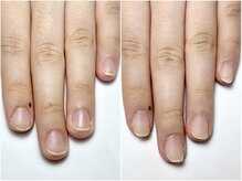 サロン アンド ルクス(Salon & Lux)/自爪育成