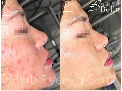 ベル 小倉(Belle)の写真